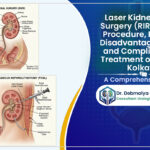 Laser Kidney Stone Surgery (RIRS/PCNL): Procedure, Benefits, Disadvantages, Risks and Complications, Treatment options in Kolkata